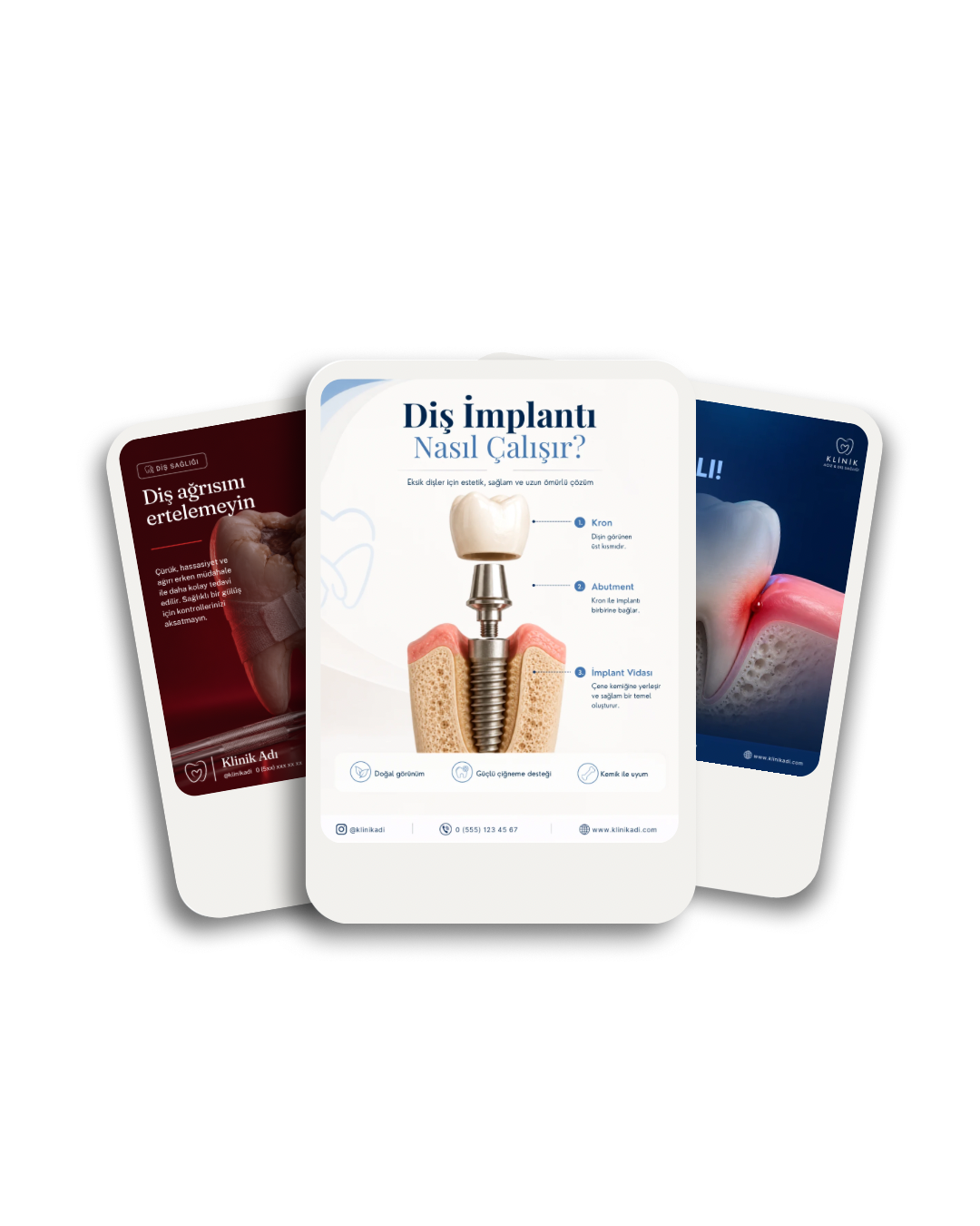 Diş Kliniği — Sosyal medya tasarımları